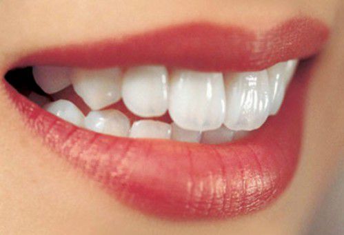 Giá làm răng sứ thẩm mỹ bao nhiêu tiền là RẺ NHẤT hiện nay? 2