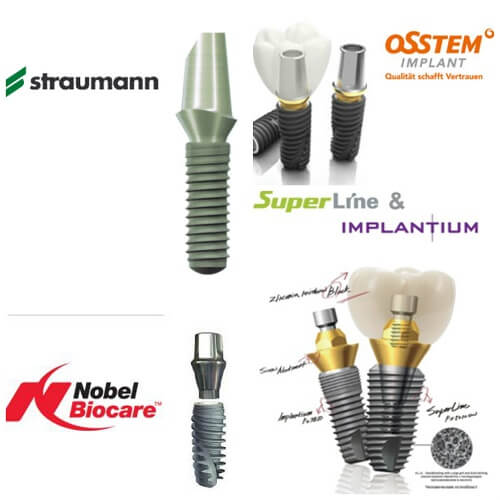 Dịch vụ trồng răng Implant tốt nhất và rẻ nhất tại Hà Nội 1