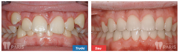 Nha khoa thẩm mỹ uy tín tại Hồ Chí Minh 8