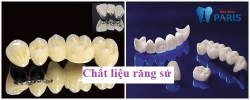 [Chia Sẻ] Địa chỉ làm cầu răng ở đâu tốt - uy tín tại Hà Nội 2