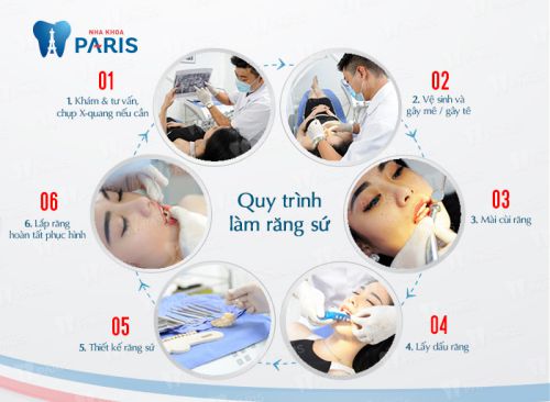 Làm răng sứ mất bao lâu - Thời gian làm răng sứ chi tiết nhất 2