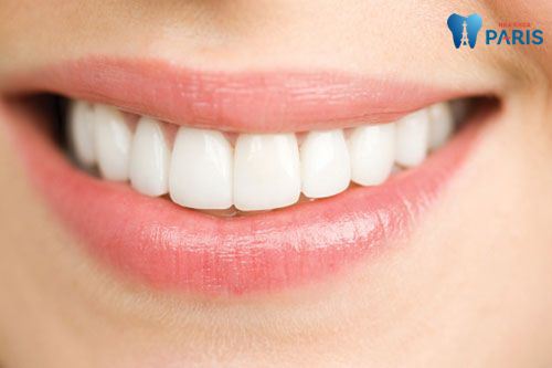 Làm răng sứ mất bao lâu - Thời gian làm răng sứ chi tiết nhất 3