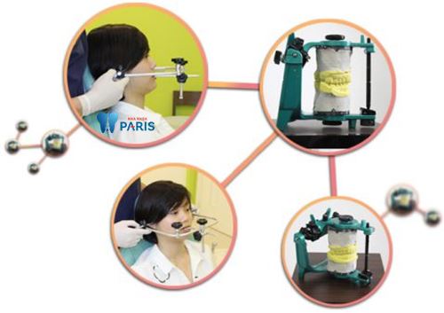 Làm mão răng sứ và những vấn đề cần biết 4