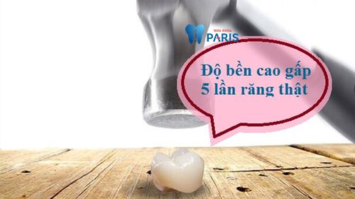 Răng sứ cercon là gì? Điều cần biết trước khi làm răng sứ 2