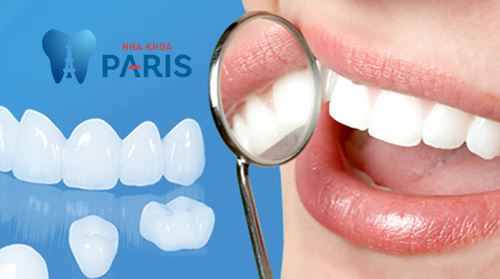 Răng sứ cercon là gì? Điều cần biết trước khi làm răng sứ 1