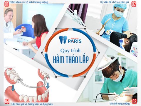 Quy trình làm răng giả tháo lắp tốt và đảm bảo nhất 1 Quy trình làm răng giả tháo lắp tốt và đảm bảo nhất 1