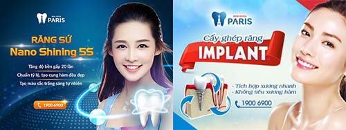 Giá trồng răng số 6 có chi phí bao nhiêu [Bảng giá CHUẨN nhất 2018] 2