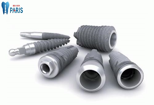 Tổng hợp các kinh nghiệm làm răng implant hưu ích nhất 3