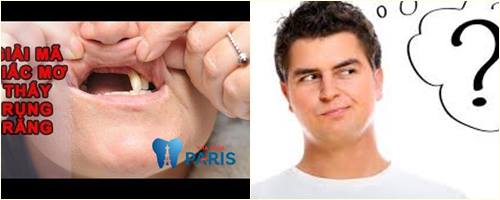 Mơ thấy rụng răng báo hiệu điều gì? Chuyên gia giải đáp 4