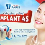 Trồng răng Implant – Giải pháp phục hồi răng mất toàn diện