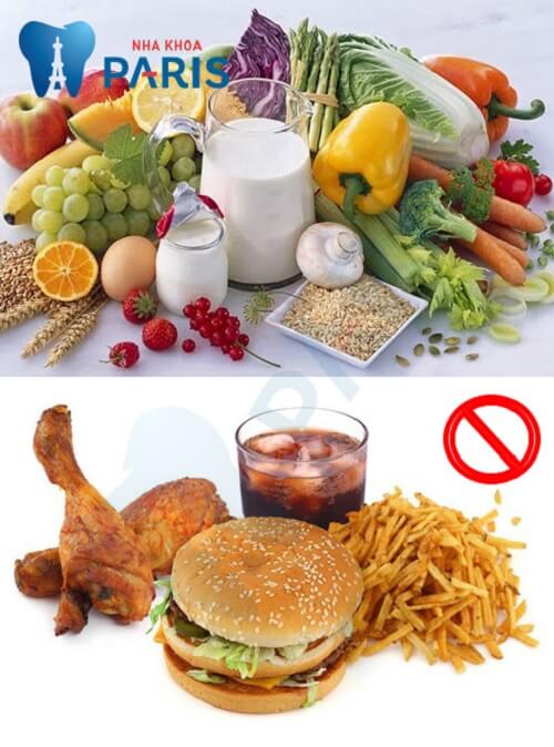 chăm sóc răng sau cấy implant