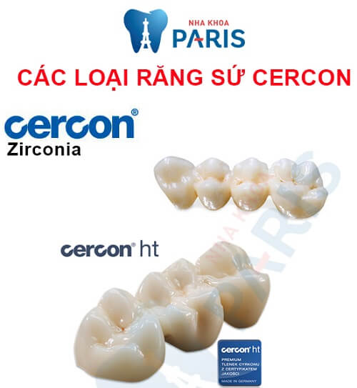 răng sứ cercon có mấy loại