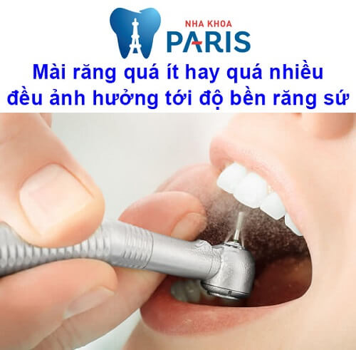 bọc răng sứ sử dụng được bao lâu