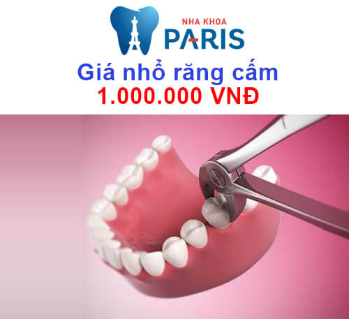 Nhổ răng hàm số 6