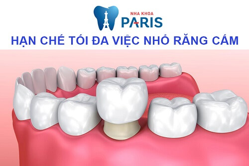 Răng cấm có thay không